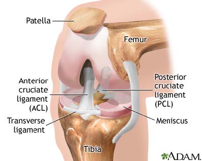 kneecap dislocation