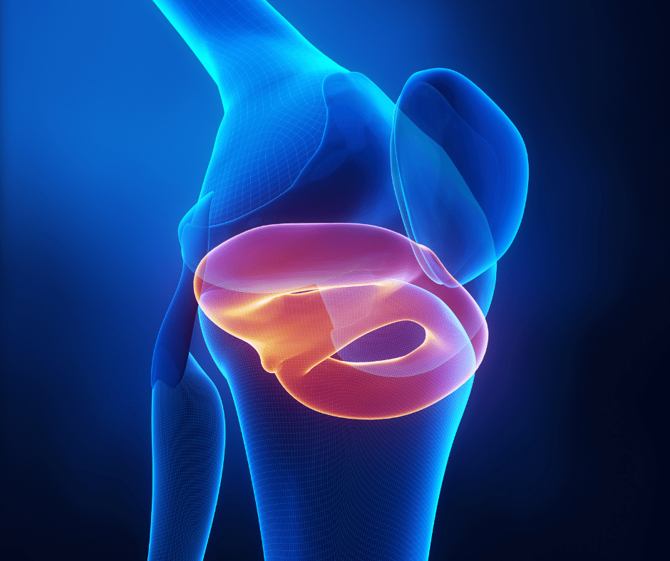 meniscal allograft transplantation